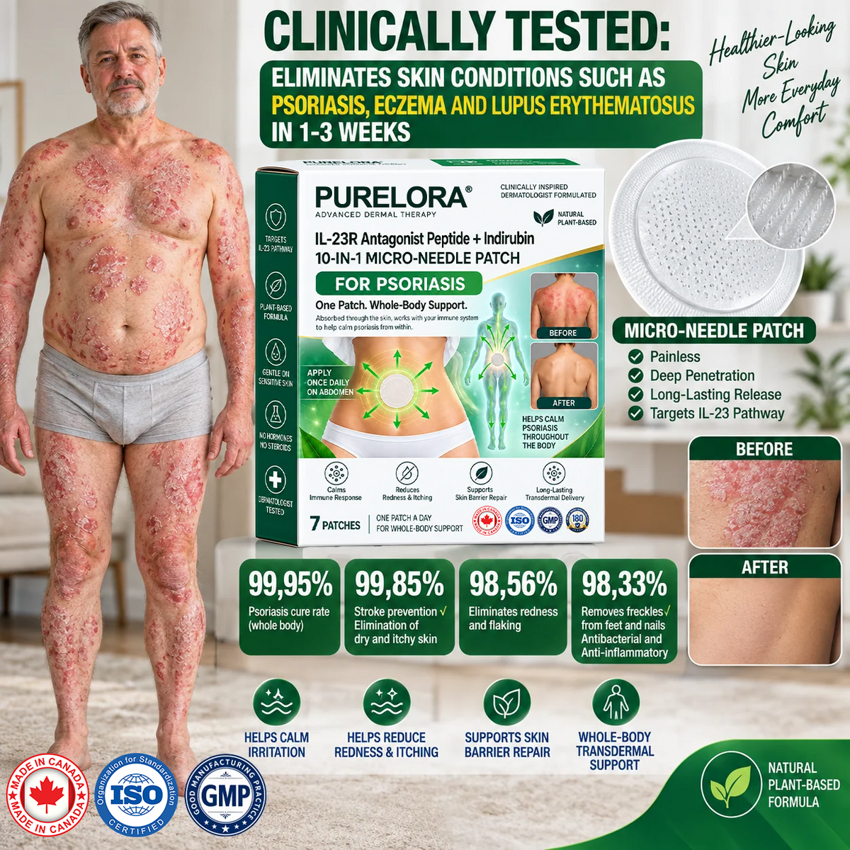 𝐏𝐔𝐑𝐄𝐋𝐎𝐑𝐀® 👩‍⚕️👩‍⚕️ 𝑰𝑳-23𝑹 𝑨𝒏𝒕𝒂𝒈𝒐𝒏𝒊𝒔𝒕 𝑷𝒆𝒑𝒕𝒊𝒅𝒆 + 𝑰𝒏𝒅𝒊𝒓𝒖𝒃𝒊𝒏 10-𝑰𝑵-1 𝑵𝒂𝒏𝒐 𝑴𝒊𝒄𝒓𝒐𝒏𝒆𝒆𝒅𝒍𝒆 𝑷𝒂𝒕𝒄𝒉 （𝑯𝒆𝒍𝒑𝒔 𝑹𝒆𝒅𝒖𝒄𝒆 𝑽𝒊𝒔𝒊𝒃𝒍𝒆 𝑹𝒆𝒅𝒏𝒆𝒔𝒔 & 𝑺𝒄𝒂𝒍𝒊𝒏𝒈, 𝑺𝒐𝒐𝒕𝒉𝒆 𝑫𝒓𝒚𝒏𝒆𝒔𝒔 & 𝑰𝒕𝒄𝒉𝒊𝒏𝒈, 𝑺𝒖𝒑𝒑𝒐𝒓𝒕 𝑯𝒆𝒂𝒍𝒕𝒉𝒊𝒆𝒓 𝑺𝒌𝒊𝒏 𝑪𝒆𝒍𝒍 𝑻𝒖𝒓𝒏𝒐𝒗𝒆𝒓 & 𝑺𝒌𝒊𝒏 𝑩𝒂𝒓𝒓𝒊𝒆𝒓 𝑹𝒆𝒑𝒂𝒊𝒓）