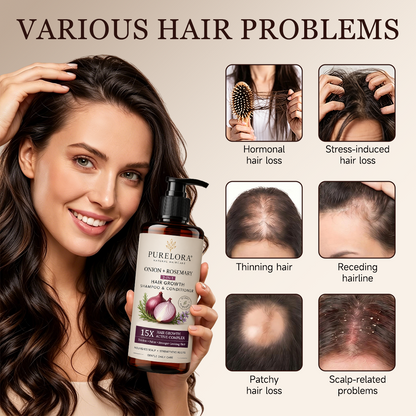 🌿👨‍⚕️ Official Canadian Flagship Store 🇨🇦 | 🔥PURELORA® Onion & Rosemary 2-in-1 Anti-Hair Loss & Growth Shampoo & Conditioner Set — Infused with a 15x hair-growth active complex to help you achieve thicker, fuller, and stronger hair.