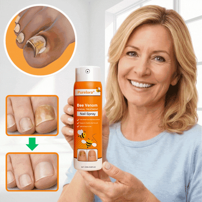 Purelora® Bee Venom Antifungal Spray | Eliminate Up to 99% of Nail Fungus in as Little as 3 Days