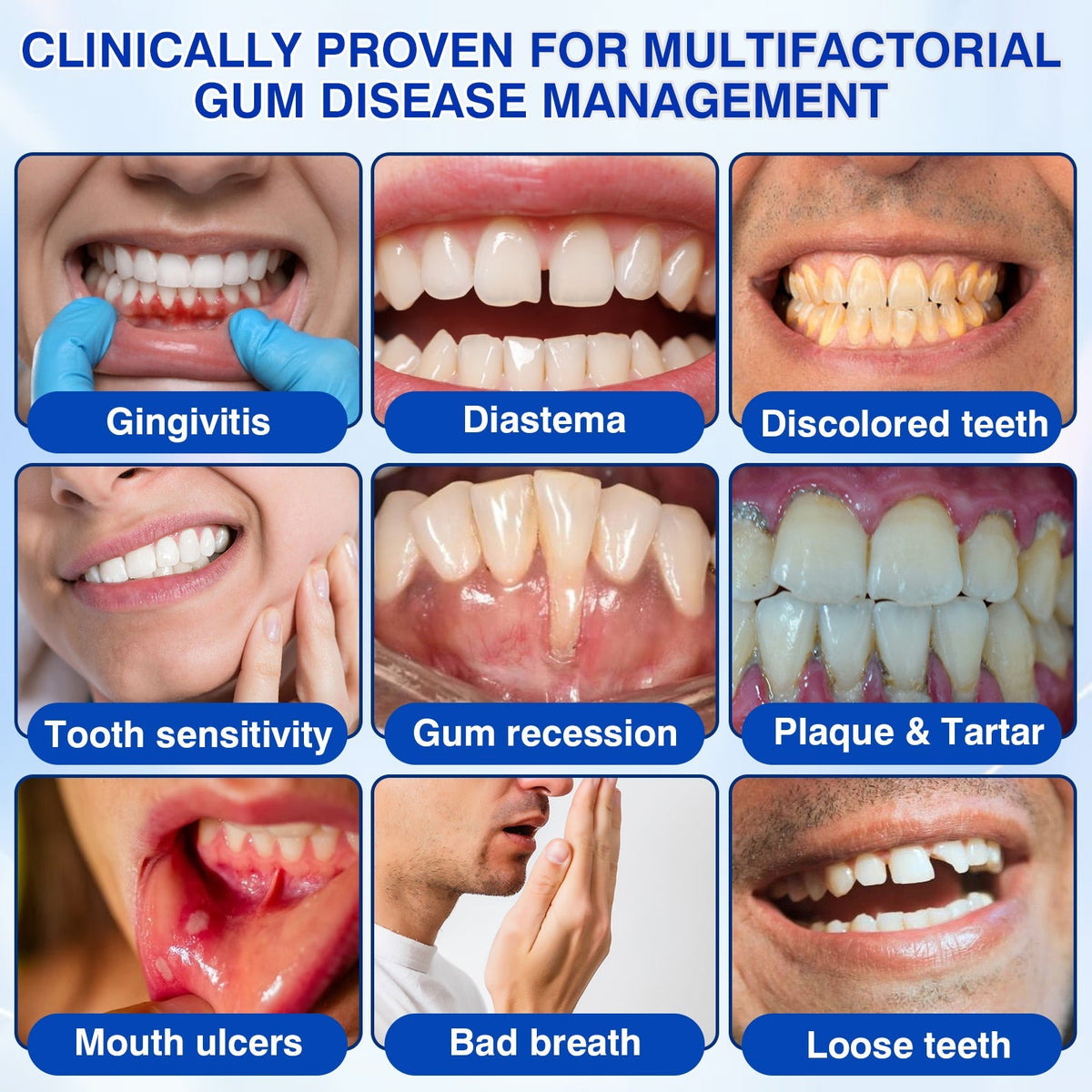 🇨🇦🦷Curalona® GumRevive Periodontal Repair Gel (For Bleeding Gums, Gum Recession & Loose Teeth)