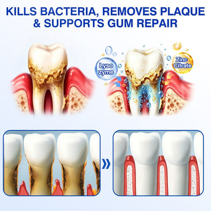 🇨🇦🦷Curalona® GumRevive Periodontal Repair Gel (For Bleeding Gums, Gum Recession & Loose Teeth)