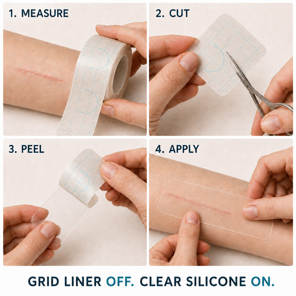 ✨💯Purelora® SILICONE SCAR THERAPY ROLL Help Soften, Flatten & Improve the Appearance of Raised Scars