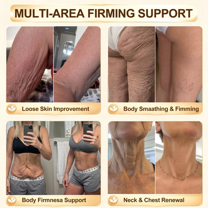 Curalona® 🏆 Bust Volume, Lift & Firming Nano Microneedle Patch Volufiline + Exosome + Copper Peptide Formula Powered by Cellular Renewal Technology