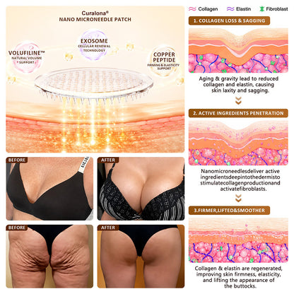 Curalona® 🏆 Bust Volume, Lift & Firming Nano Microneedle Patch Volufiline + Exosome + Copper Peptide Formula Powered by Cellular Renewal Technology