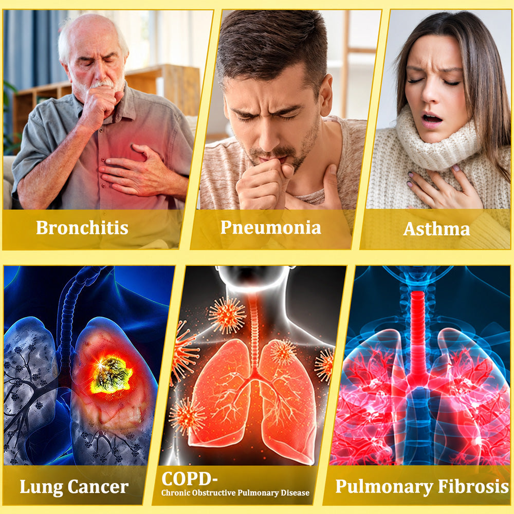 🍀🍀🐝🇨🇦 Official Store:𝐏𝐔𝐑𝐄𝐋𝐎𝐑𝐀®  6-in-1 Herbal BeePropolis Lung Cleanse Spray（👨‍⚕️Directly acts on COPD, asthma, chronic bronchitis (CB), respiratory infections, lung cancer, sinusitis, and other conditions🫁）