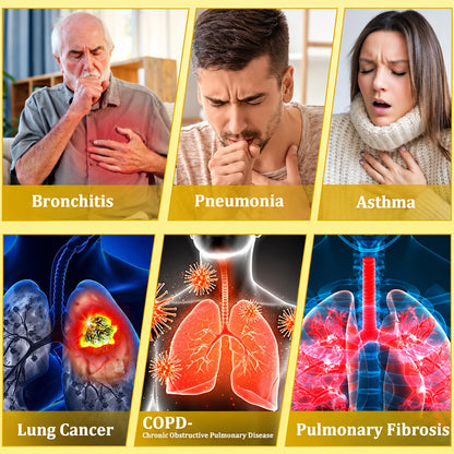 🍀🍀🐝🇨🇦 Official Store:𝐏𝐔𝐑𝐄𝐋𝐎𝐑𝐀®  6-in-1 Herbal BeePropolis Lung Cleanse Spray（👨‍⚕️Directly acts on COPD, asthma, chronic bronchitis (CB), respiratory infections, lung cancer, sinusitis, and other conditions🫁）