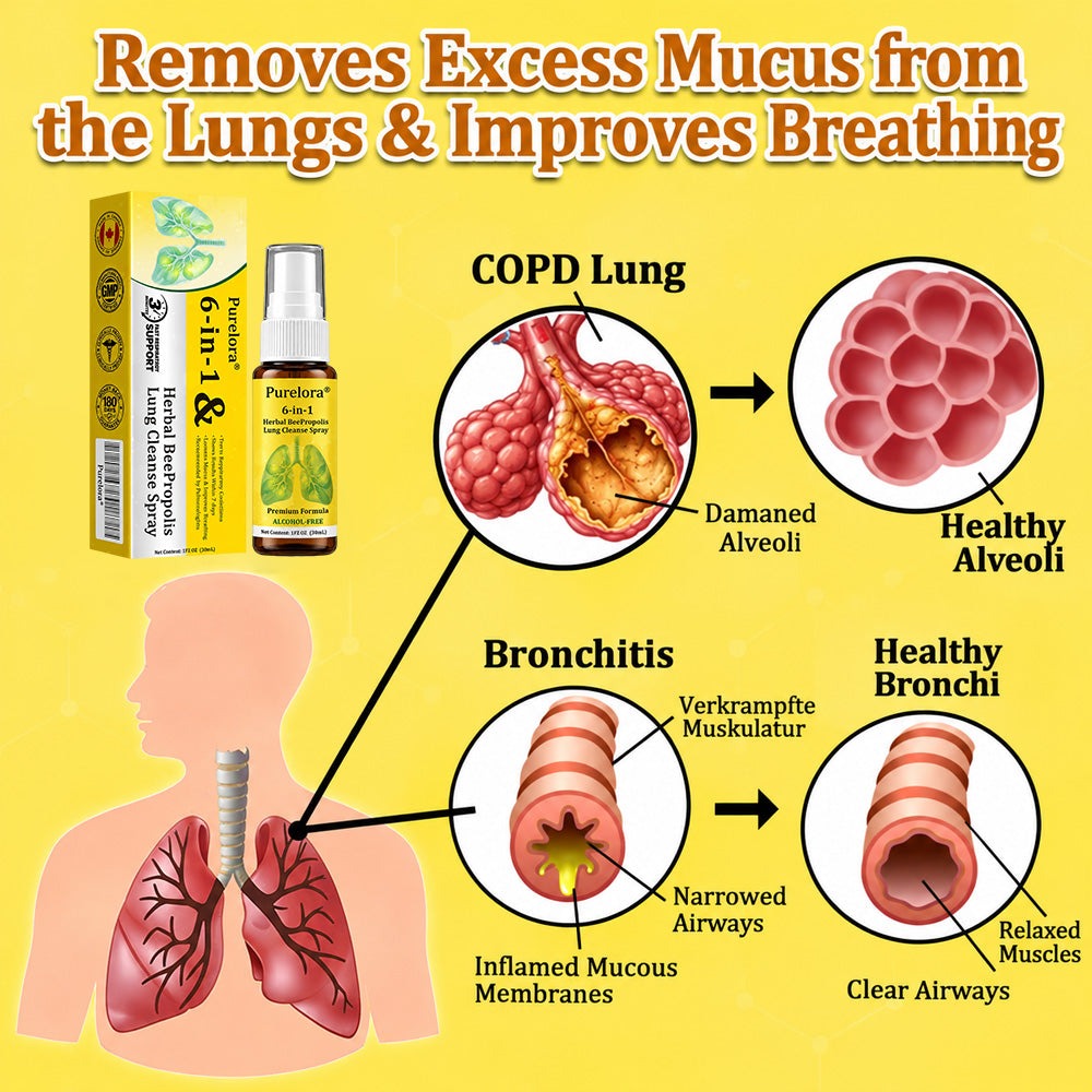 🍀🍀🐝🇨🇦 Official Store:𝐏𝐔𝐑𝐄𝐋𝐎𝐑𝐀®  6-in-1 Herbal BeePropolis Lung Cleanse Spray（👨‍⚕️Directly acts on COPD, asthma, chronic bronchitis (CB), respiratory infections, lung cancer, sinusitis, and other conditions🫁）