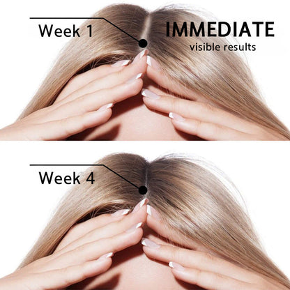 🌿👨‍⚕️ Official Canadian Flagship Store 🇨🇦 | 🔥PURELORA® Onion & Rosemary 2-in-1 Anti-Hair Loss & Growth Shampoo & Conditioner Set — Infused with a 15x hair-growth active complex to help you achieve thicker, fuller, and stronger hair.
