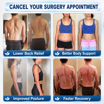 Curalona® Magnesium Chloride Cream | Relieve sciatica in just 15 minutes!